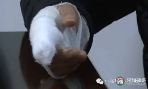 小伙去足浴店洗脚 竟把手指给洗没了